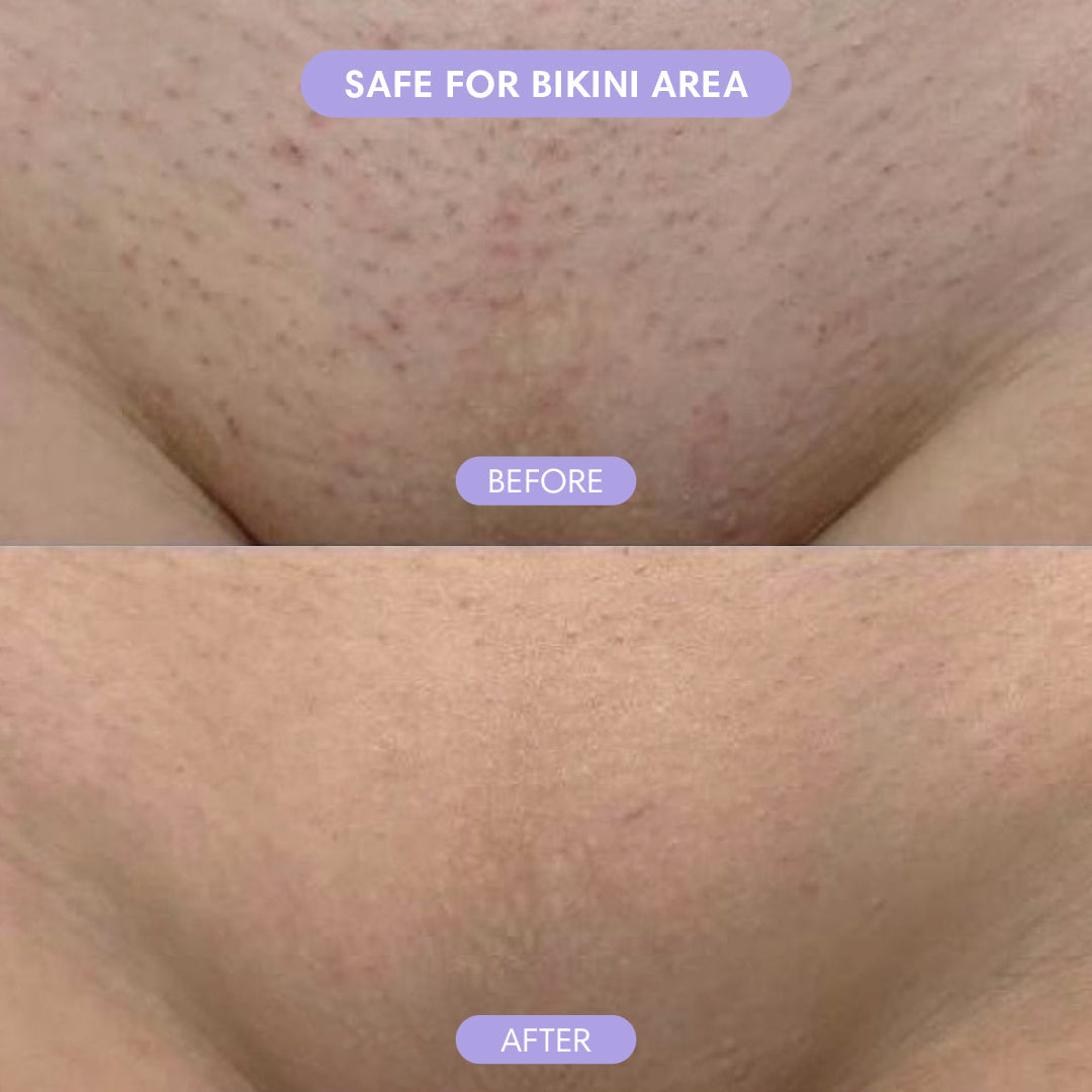 SmoothSkin Crystal Eraser